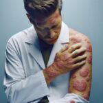 Was verursacht Psoriasis? Ein Blick auf die möglichen Auslöser